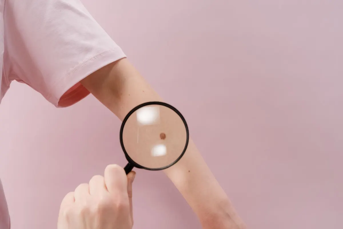 A magnifier held close over the skin of a forearm, examining it